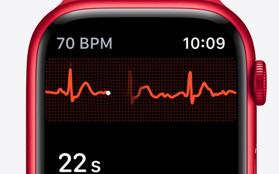 La version Serie 8 génère un ECG correspondant à un électrocardiogramme.